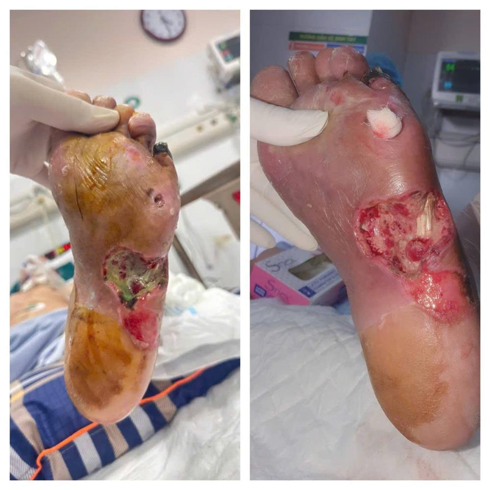 /images/companies/benhvienducgiang/images/2025/hoạt động bv 2025/tháng 10/566271551_844491241250126_1755052040202232189_n.jpg